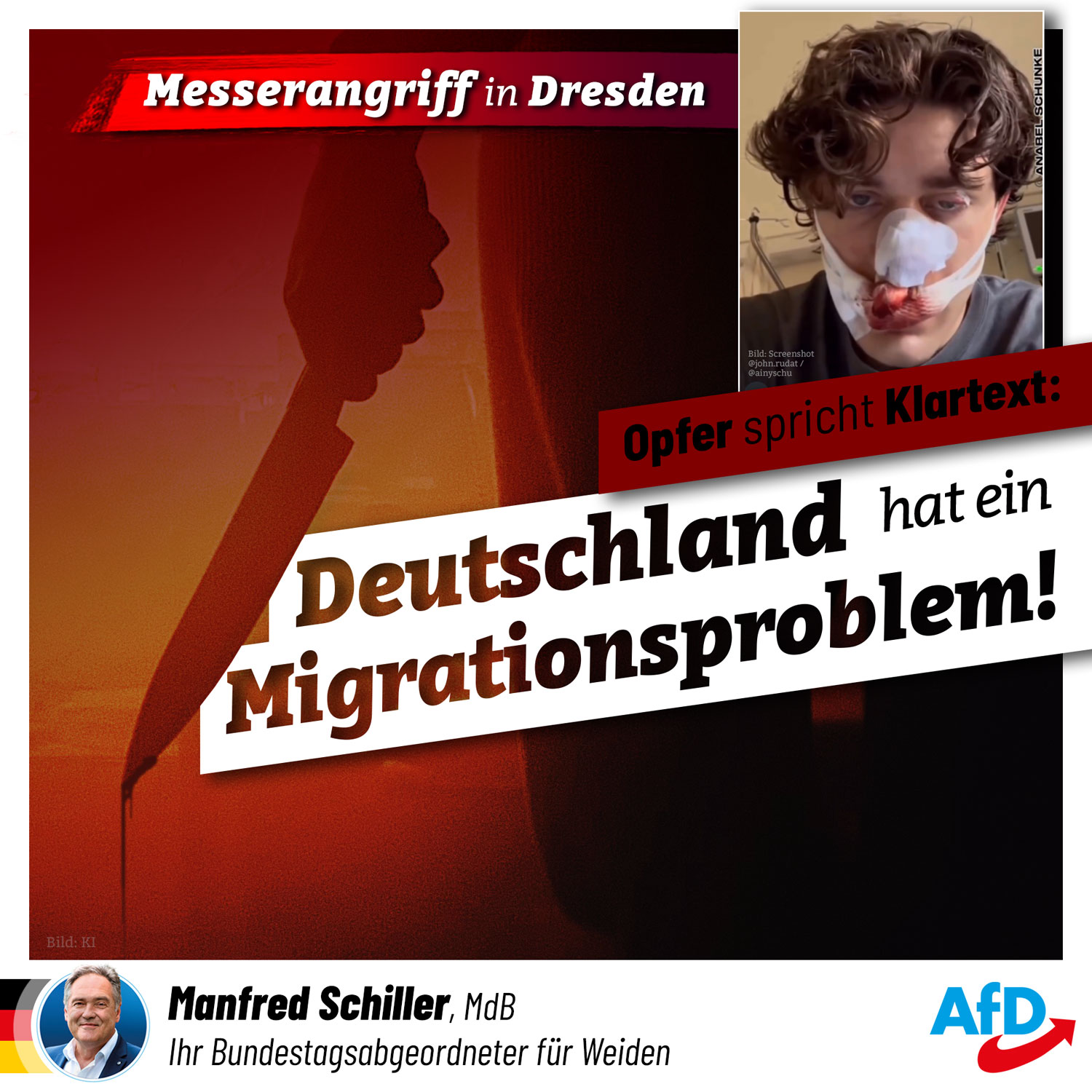 Messerattacke in Dresden - US-Bürger niedergestochen